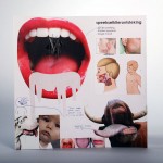 Sweet Disease