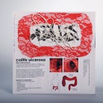 Sweet Disease